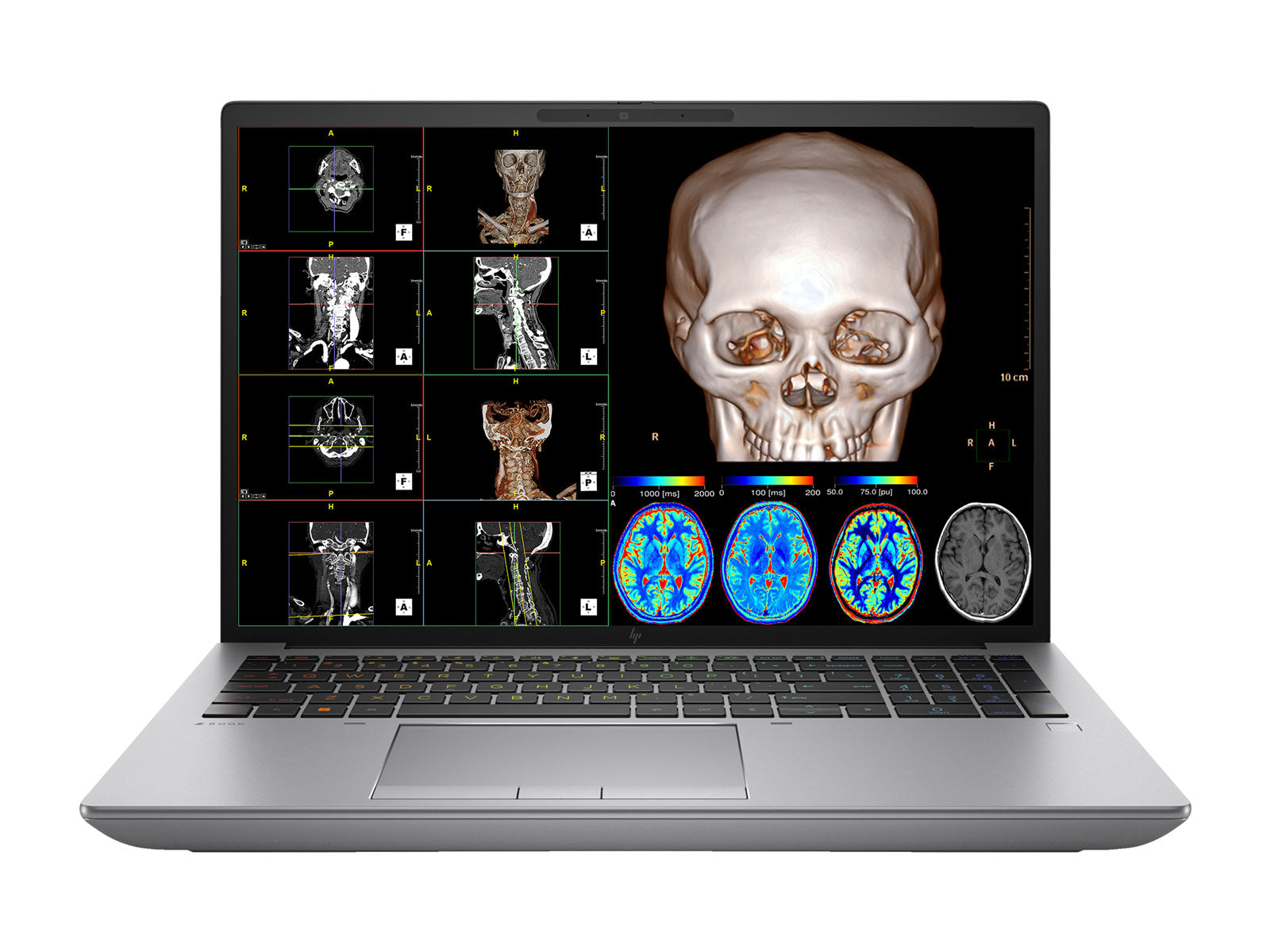 HP ZBook Fury 16 G10 Mobile Radiology Workstation | 16" WUXGA DICOM Calibrated | Core i9-13950HX @ 5.5GHz | 128GB DDR5 | 1TB NVMe SSD | RTX 5000 Ada 16GB | WiFi 6E