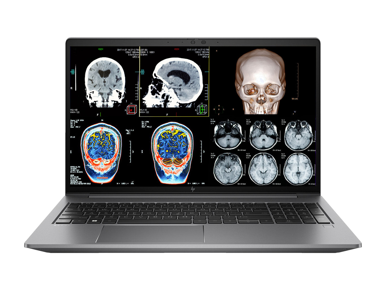 HP ZBook Power G9 | Ultra9 185U | 64GB DDR5 | 512GB NVMe | RTX 2000Ada