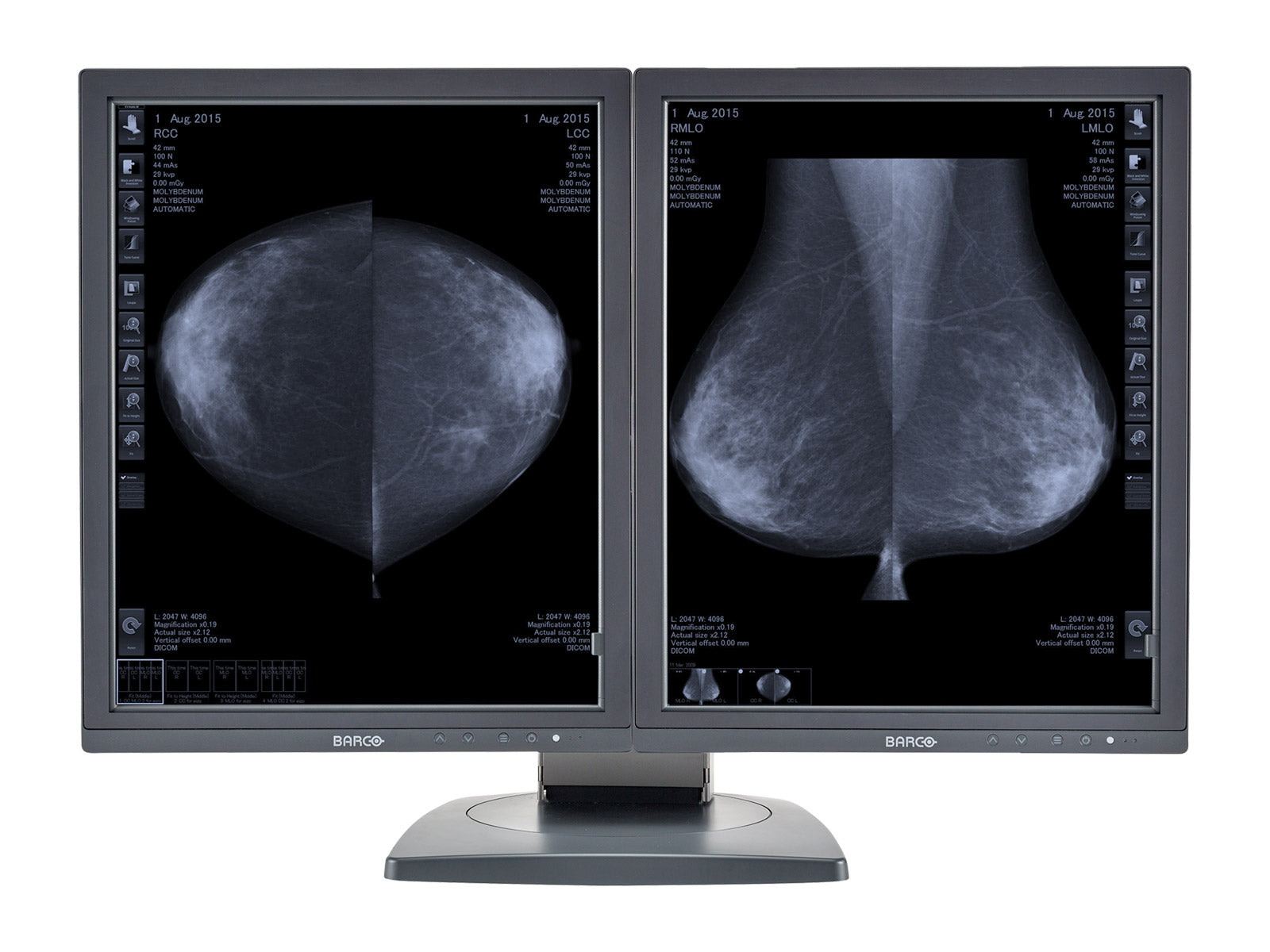 Complete Mammography Reading Station | Barco MDCG-5121 5MP Grayscale 3D-DBT Displays | HP Workstation | Dictation Mic | Worklist Monitor (MD5121Z4R)