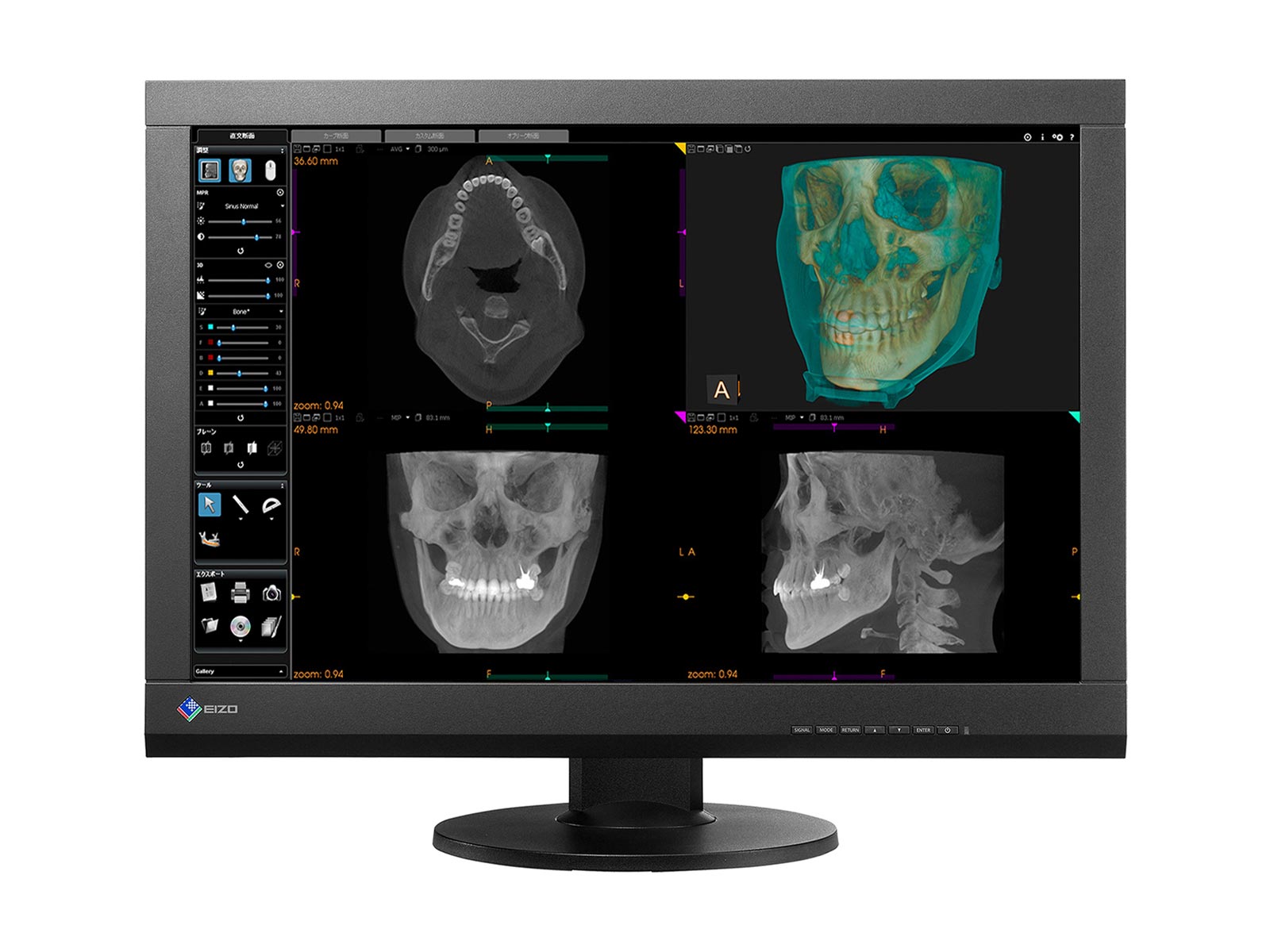 Eizo RadiForce MX242W 2.3MP 24 Color Clinical Review Display (MX242W)