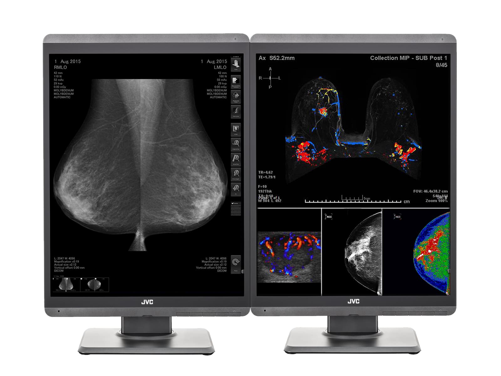 JVC Totoku CL-S500 5MP 21" Color LED Mammo 3D-DBT Breast Imaging Display (CL-S500)