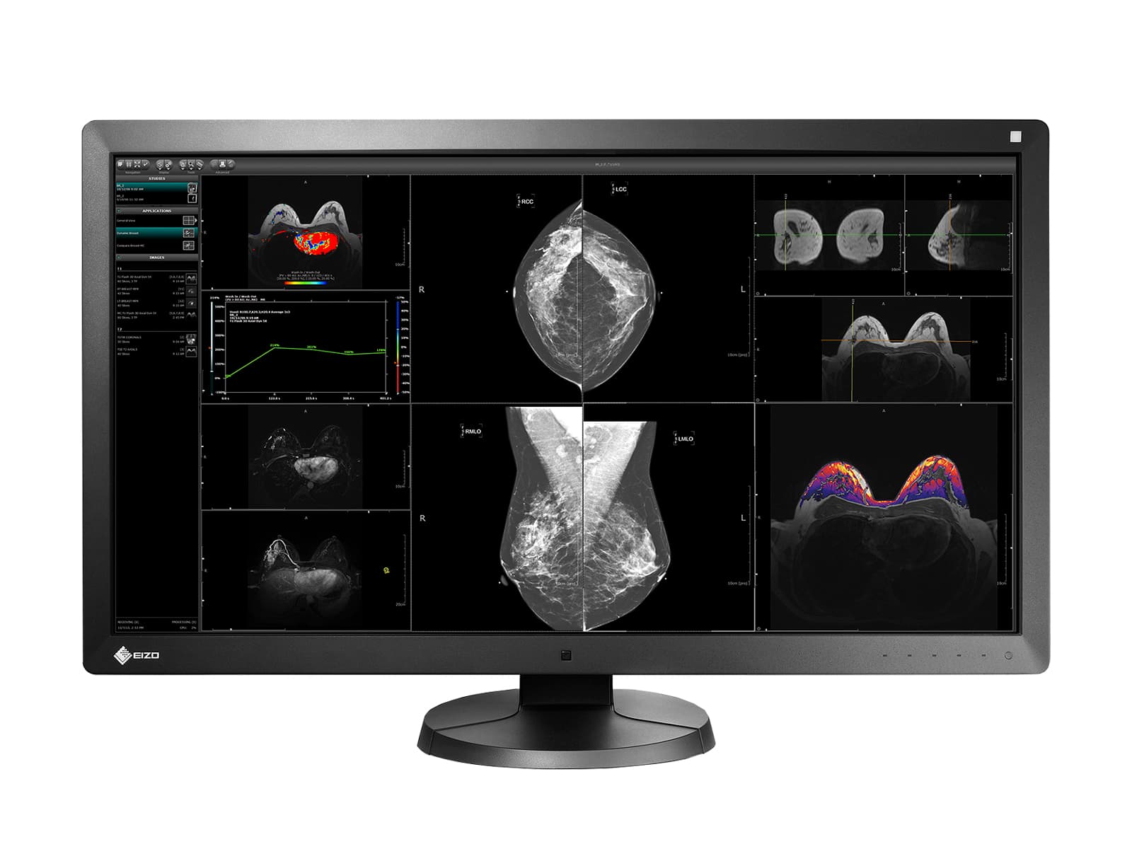 Eizo RadiForce RX850 8MP 31" Fusion Color LED Mammo 3D-DBT Breast Imaging Display (RX850-BK)