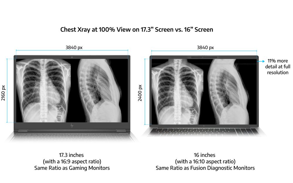 Why 16-Inch Displays with a Taller Aspect Ratio are Better for Radiologists than Traditional 17.3-Inch Screens