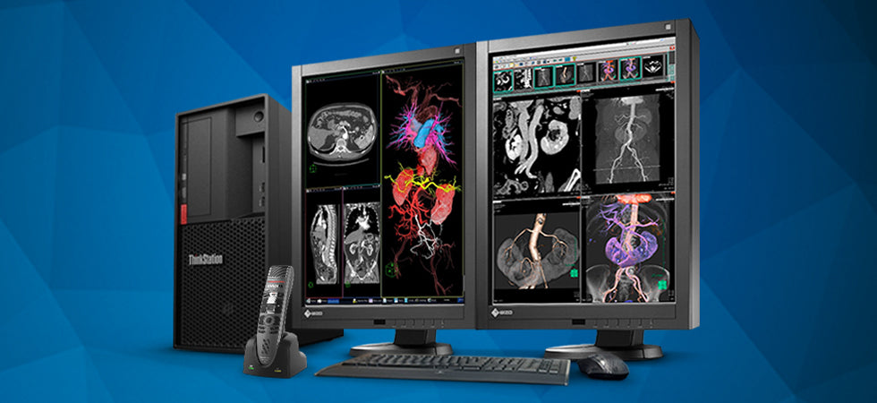 How to Choose the Right Diagnostic Display and PACS Workstation?