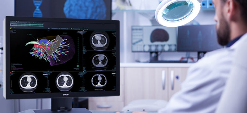 Why Radiologists Should Use Medical Diagnostic Displays to Read X-Rays?