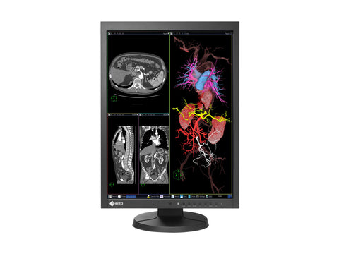 Monitor de exibição de revisão clínica colorida Eizo RadiForce MX215 2MP 21