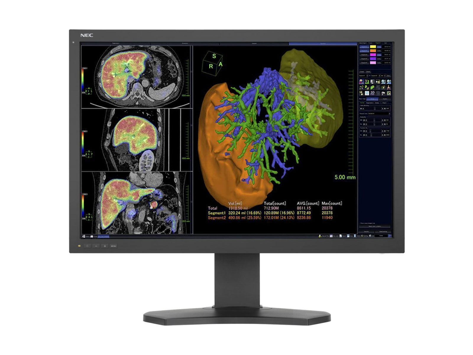 NEC Complete PACS General Radiology Station | HP Workstation