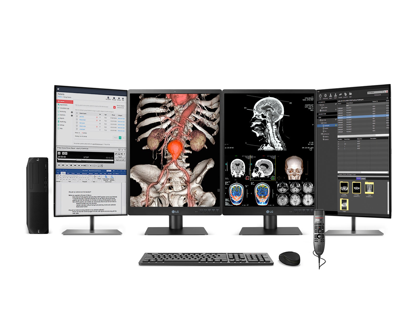 Complete PACS General Radiology Station | LG 21HQ513D 3MP 21" Color | HP Z2 G9 SFF Workstation | Dictation Mic | Worklist Monitor (21HQ513DZ2G9SFF)