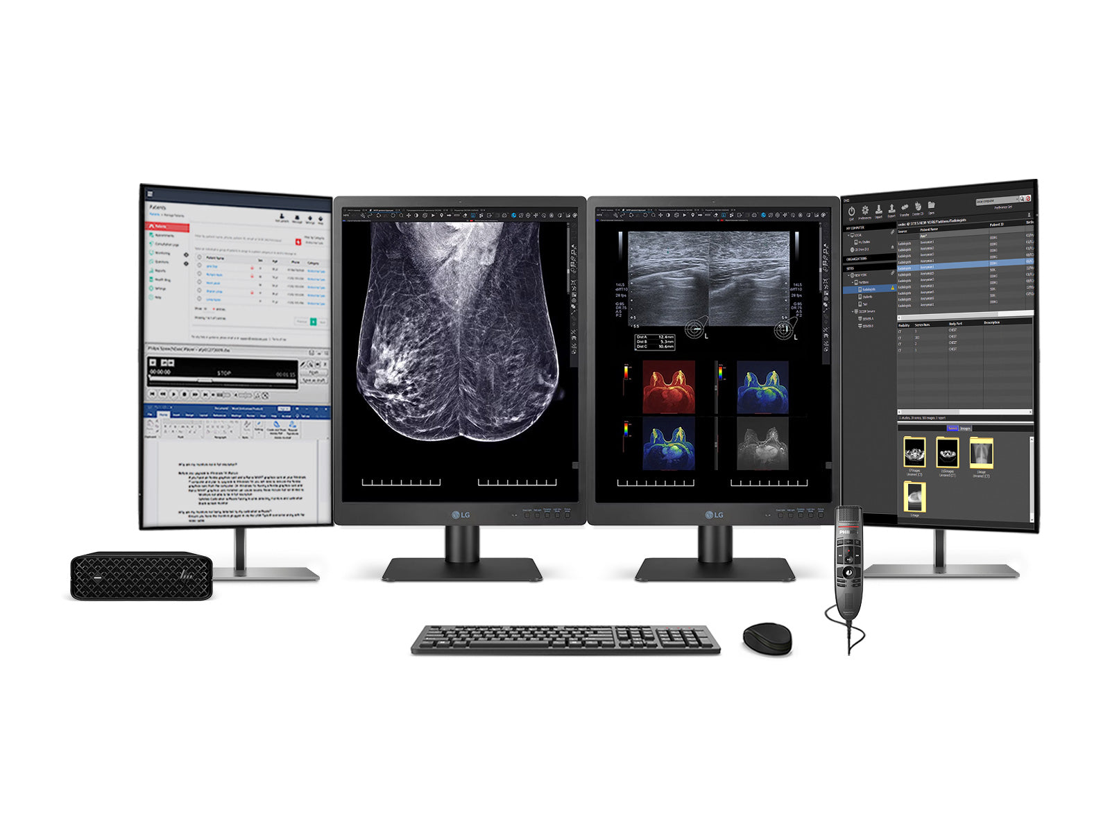 Complete Mammography Reading Station | LG 5MP 21" Color | HP Z2 Mini G9 Workstation | Dictation Mic | Worklist Monitors (21HQ613DZ2MNG9)