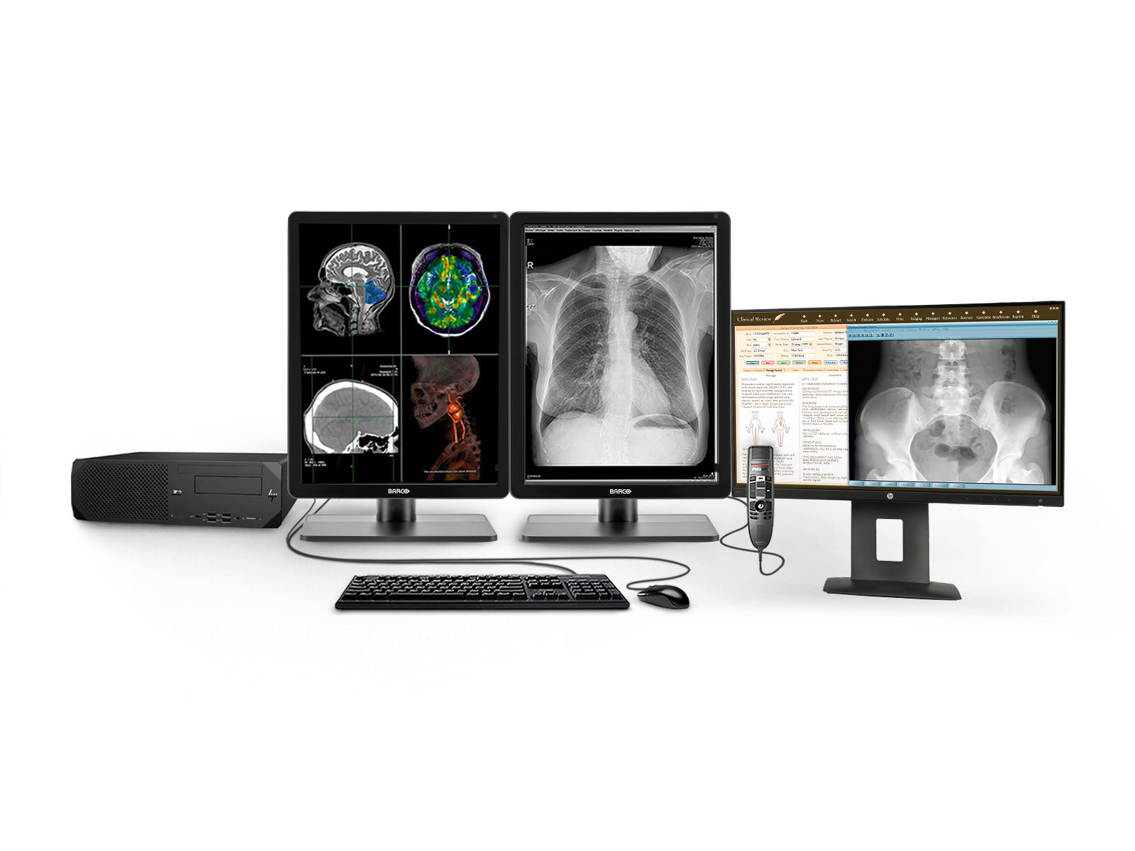 Barco Complete PACS General Radiology Station | HP Workstation