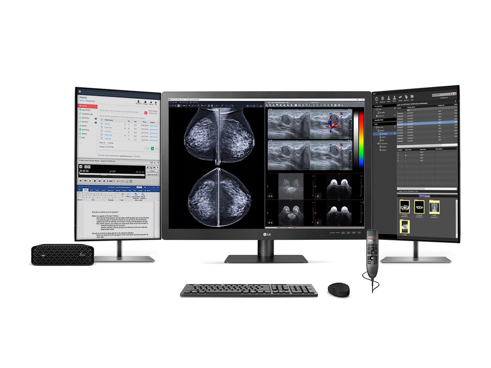 Complete Mammography Reading Station | LG 12MP Fusion 31.5" Color | HP Z2 Mini G9 Workstation | Dictation Mic | Worklist Monitors (31HN713DZ2MNG9)