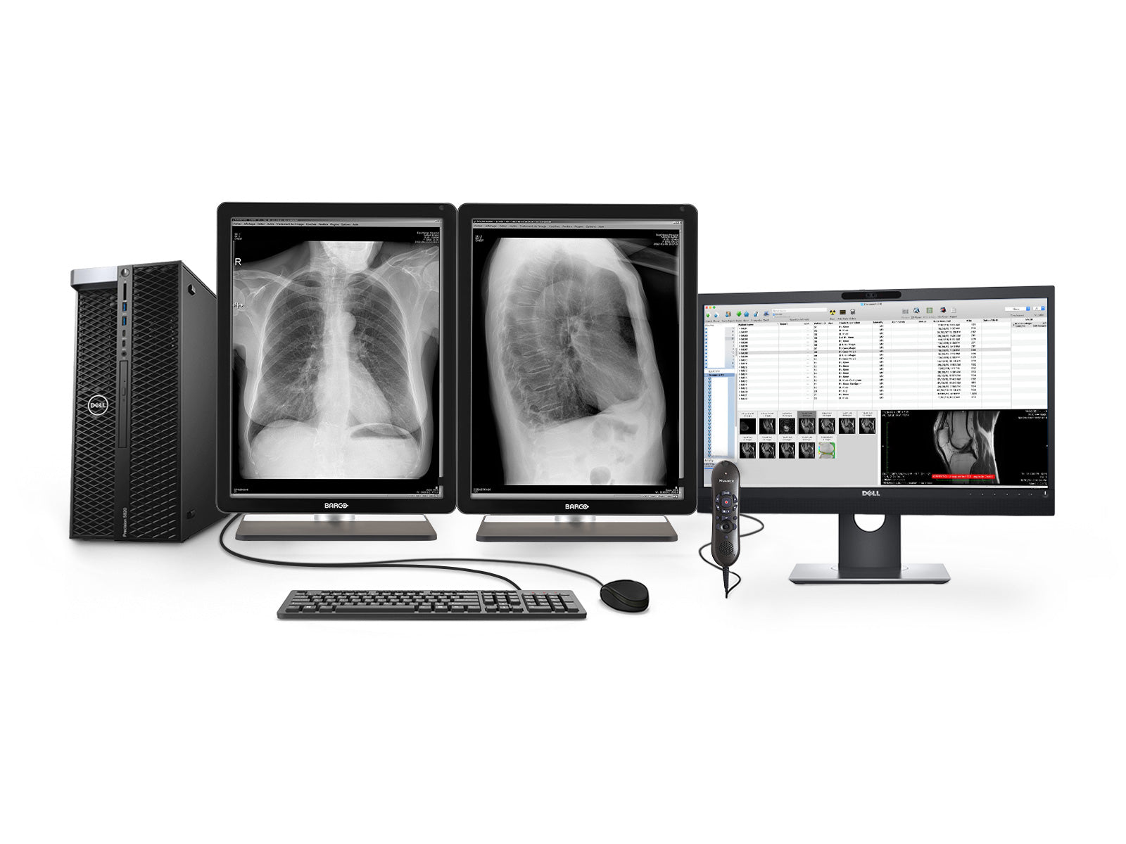 Complete PACS General Radiology Station | Barco 3MP Grayscale LED Displays | Dell Workstation | Dictation Mic | Worklist Monitor (3221T5820R)
