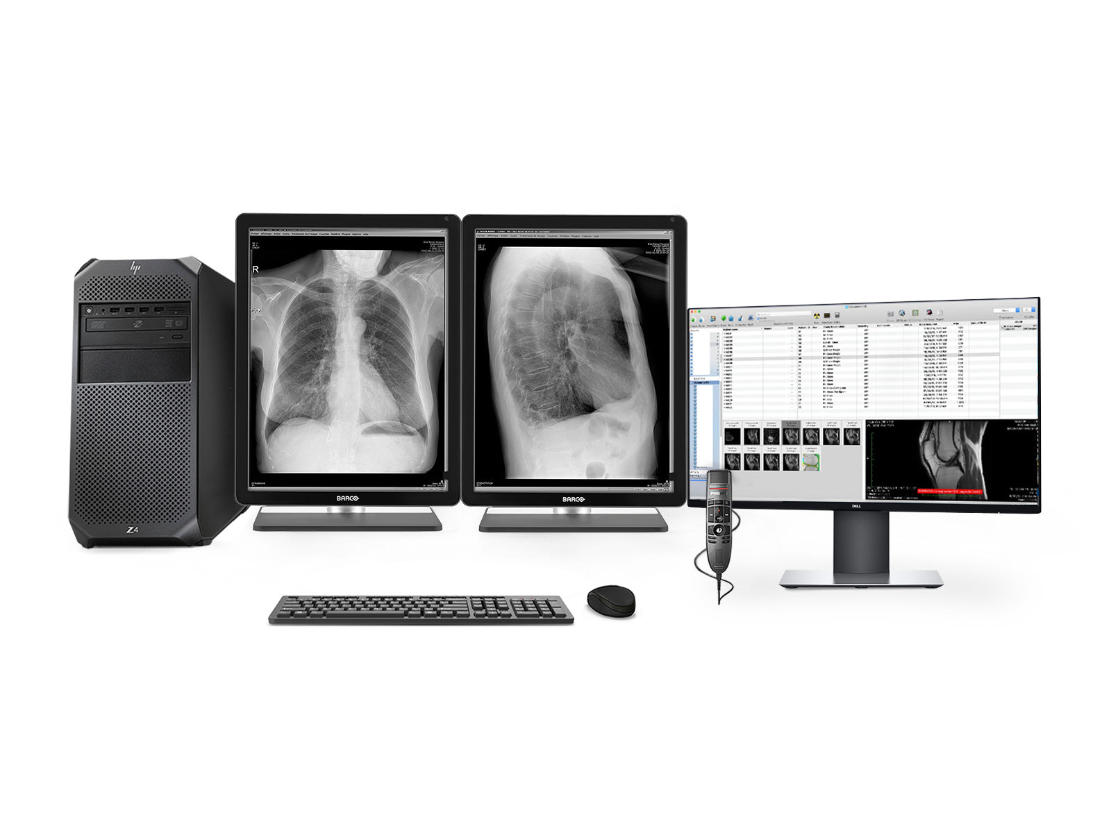 Complete PACS General Radiology Station | Barco Coronis MDCG-3221 3MP Grayscale LED Displays | HP Workstation | Dictation Mic | Worklist Monitor (3221Z4R)