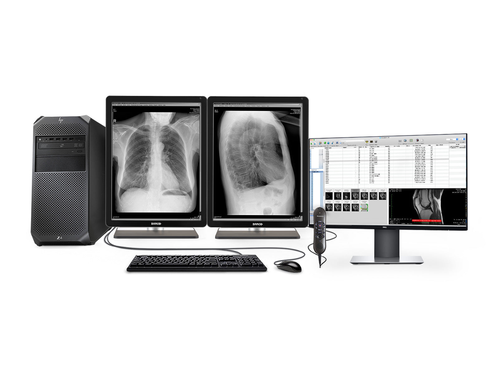 Complete PACS Gen Rad Station | Barco Displays | HP Workstation