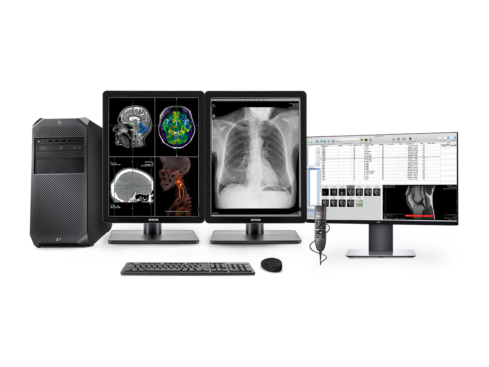 Complete PACS General Radiology Station | Barco Nio MDNC-3321 3MP Color LED Displays | HP Workstation | Dictation Mic | Worklist Monitor (3321Z4R)