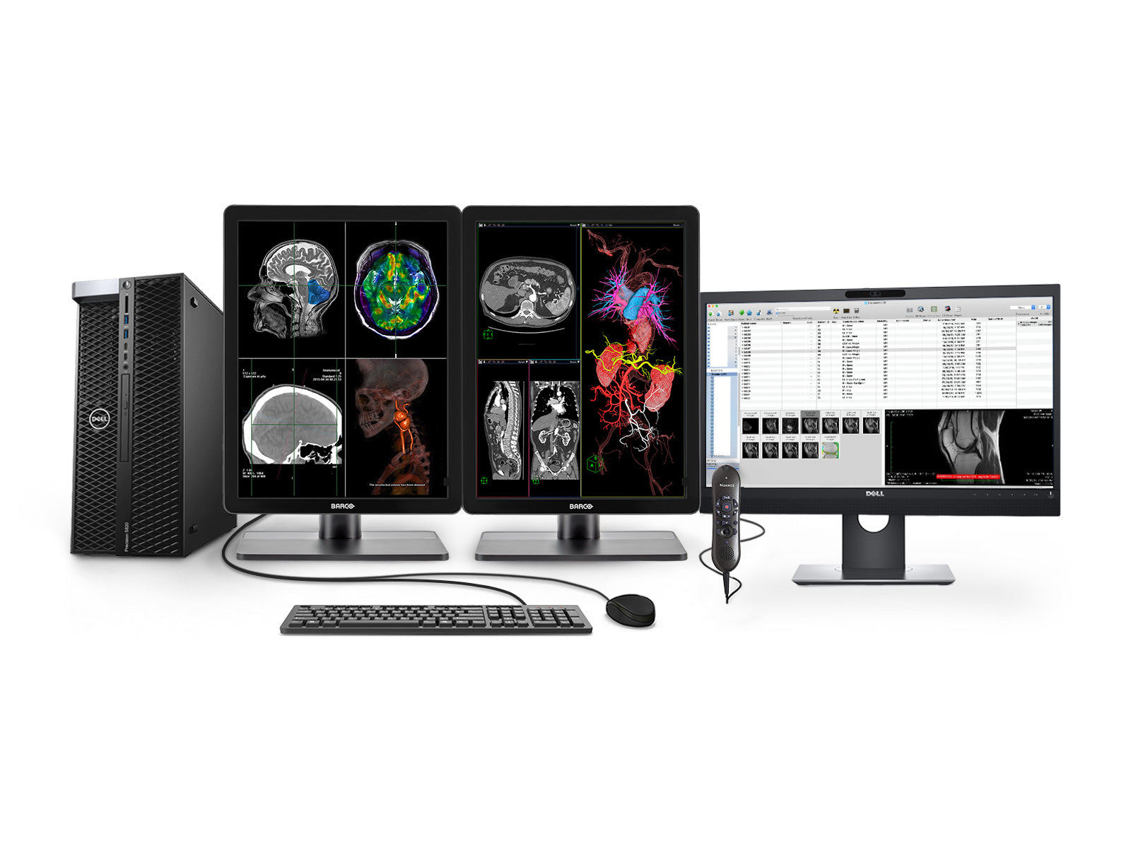 Complete PACS General Radiology Station | Barco 3MP Color LED Displays | Dell Workstation | Dictation Mic | Worklist Monitor (34215820)