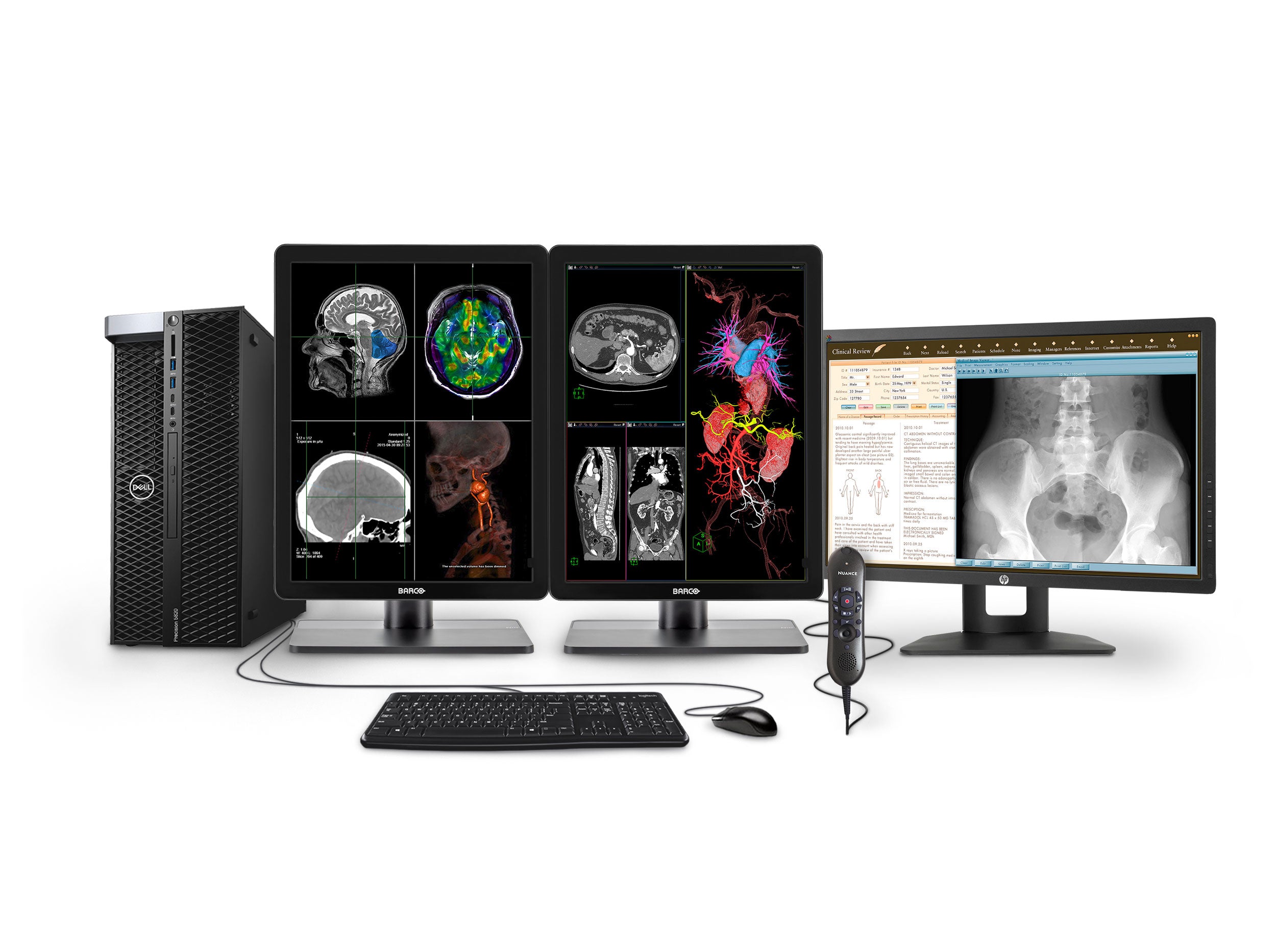 Complete PACS General Radiology Station | Barco 3MP Color LED Displays | Dell Workstation | Dictation Mic | Worklist Monitor (3421P520) (Copy) Monitors.com 