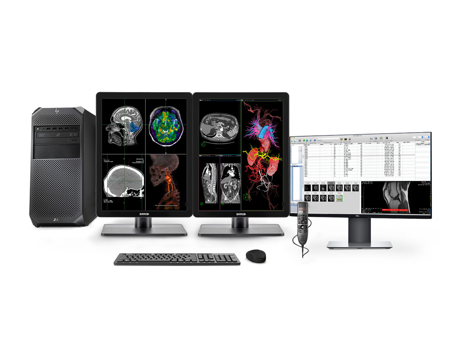 Complete PACS General Radiology Station | Barco Nio MDNC-3421 3MP Color LED Displays | HP Workstation | Dictation Mic | Worklist Monitor (3421Z4R)