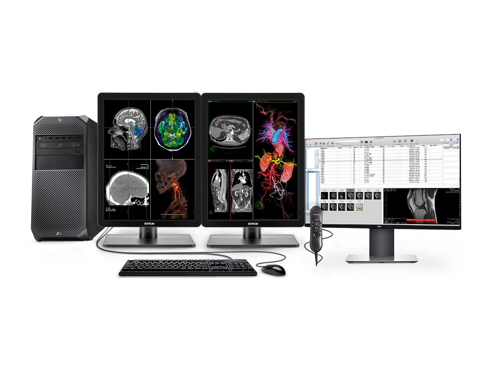 Complete PACS General Radiology Station | Barco 3MP Color LED Displays | HP Workstation | Dictation Mic | Worklist Monitor (3421Z4R) Monitors.com 