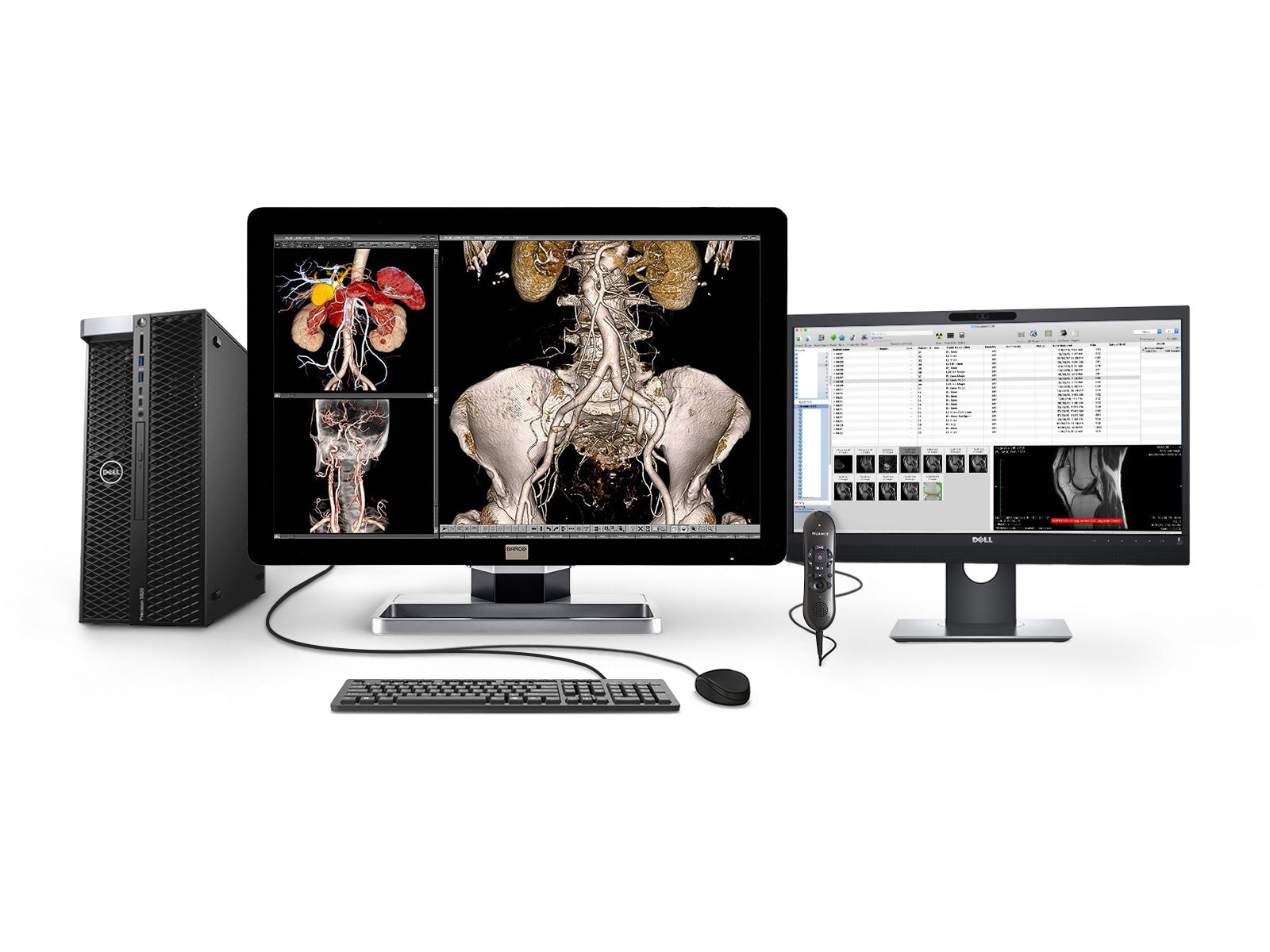 Complete PACS General Radiology Station | Barco 4MP Color LED Display | Dell Workstation | Dictation Mic | Worklist Monitor (43305820) (Copy) Monitors.com 