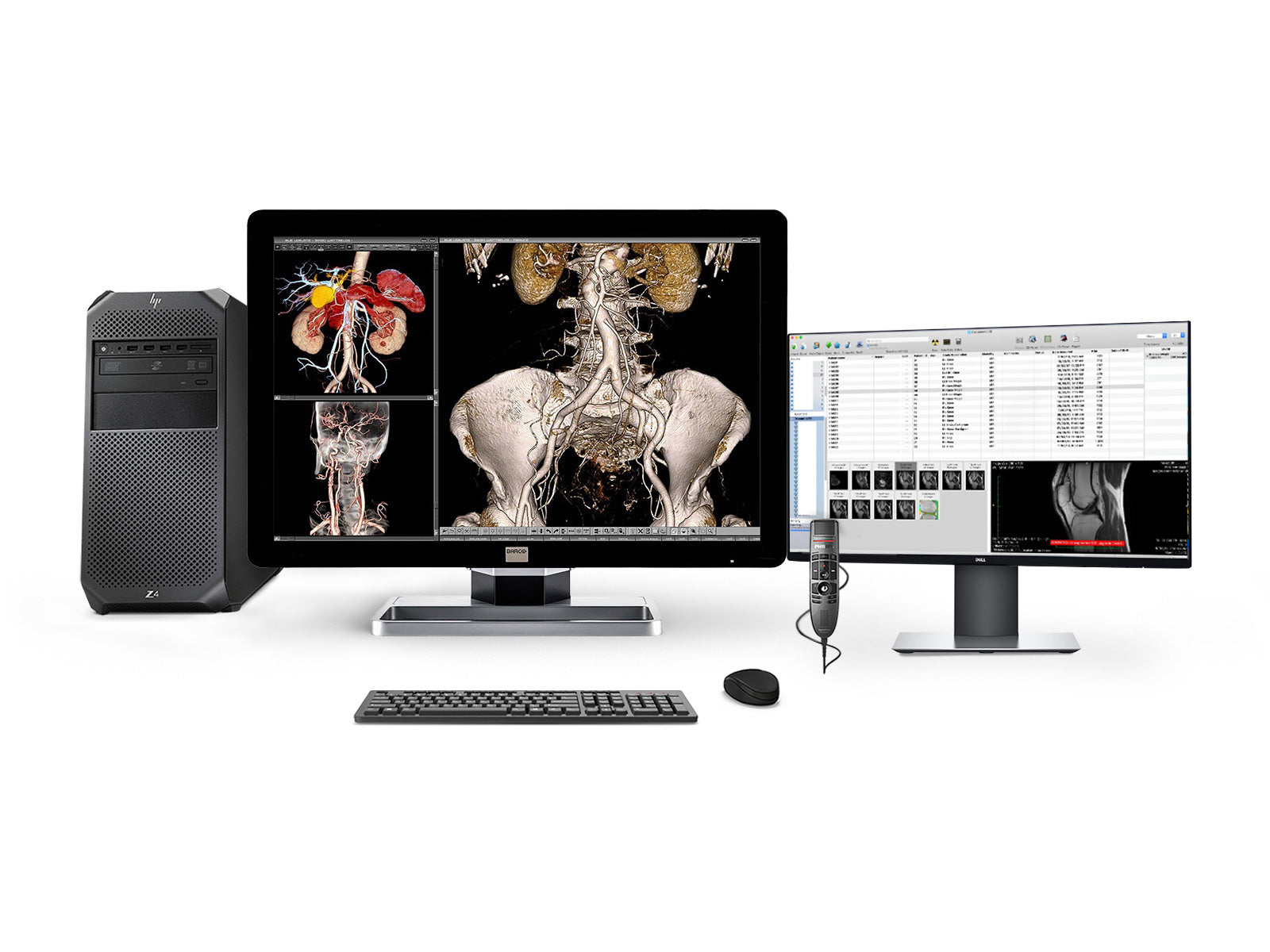 Complete PACS General Radiology Station | Barco Coronis MDCC-4330 4MP Color LED Display | HP Workstation | Dictation Mic | Worklist Monitor (4330Z4R)