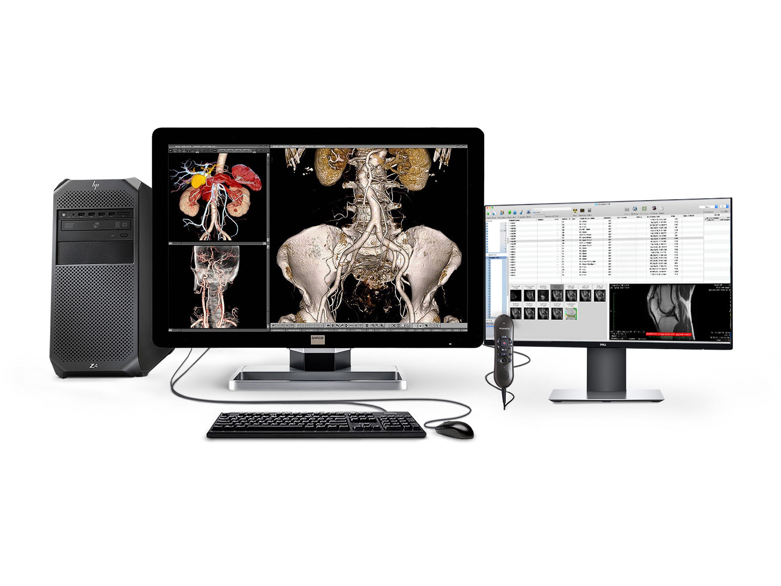 Complete PACS General Radiology Station | Barco 4MP Color LED Display | HP Workstation | Dictation Mic | Worklist Monitor (4330Z4R) Monitors.com 