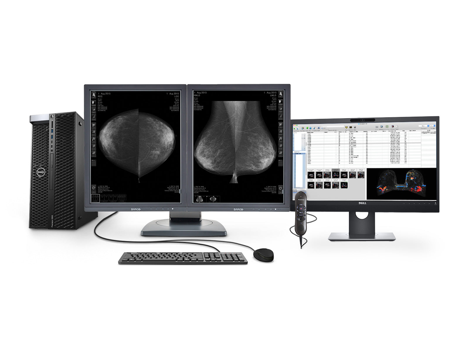 Complete Mammography Reading Station | Barco Display| Dell Workstation