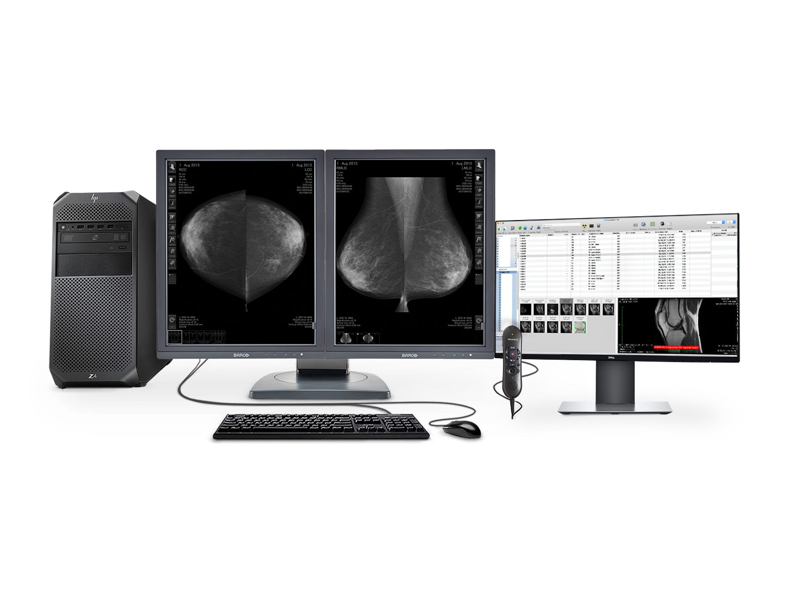 Complete Mammography Reading Station | Barco Display| HP Workstation