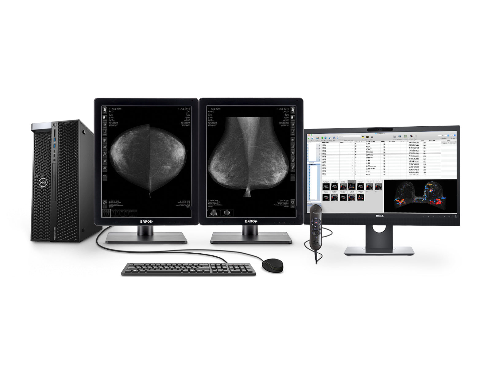 Complete Mammography Reading Station | Barco 5MP Grayscale LED Monitor | Dell Workstation | Dictation Mic | Worklist Monitor (52215820)