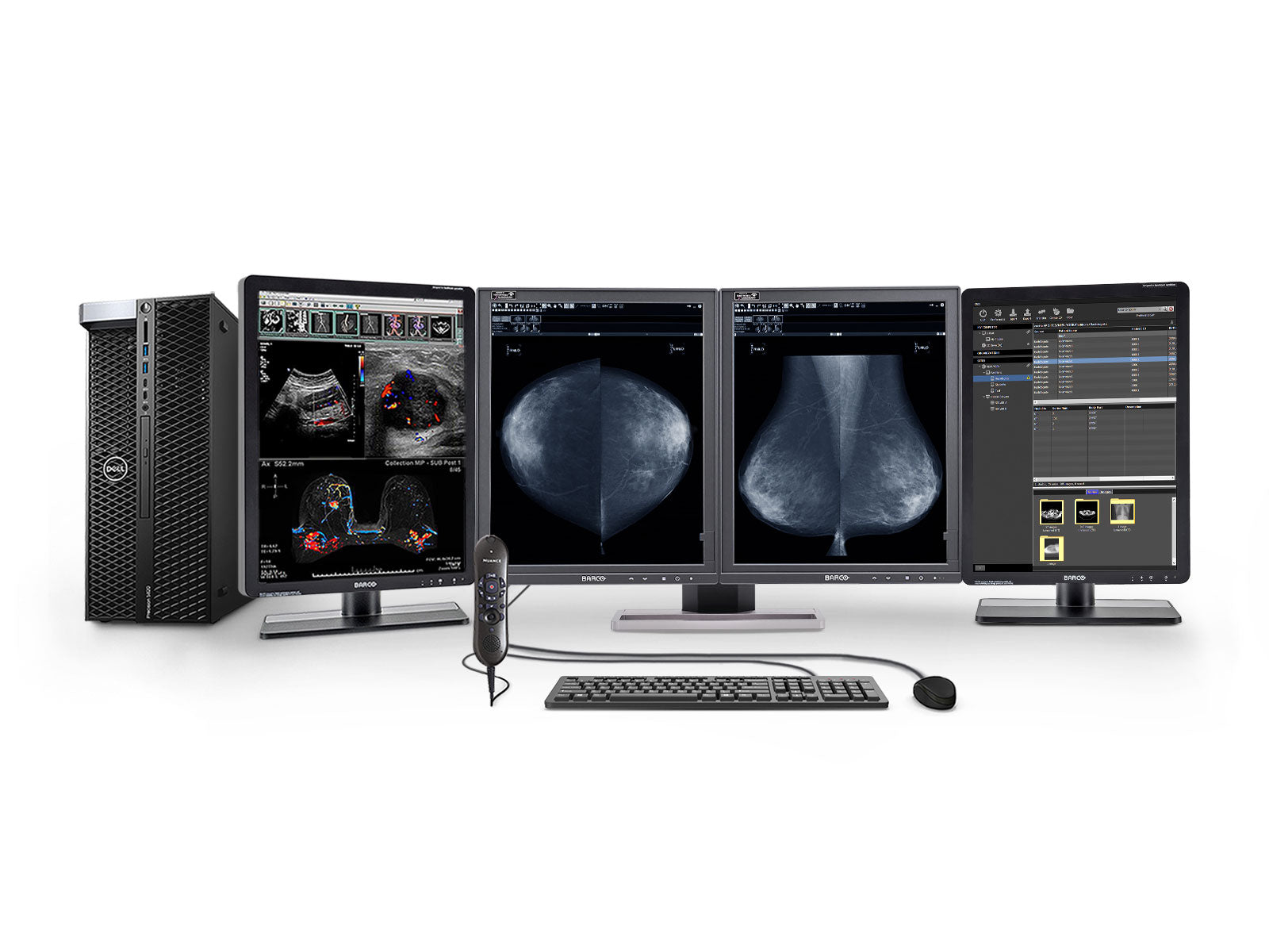Complete Mammography Reading Station | Barco 5MP Grayscale LED Monitor | HP Workstation | Dictation Mic | Worklist Monitors (5221Z4)