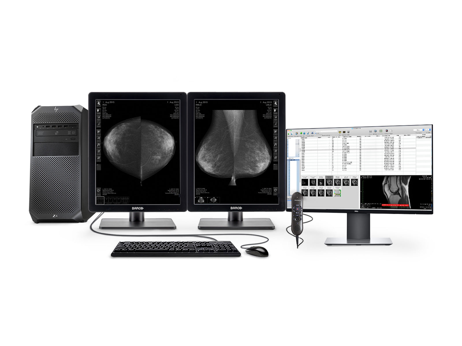 Complete Mammography Reading Station | HP Workstation