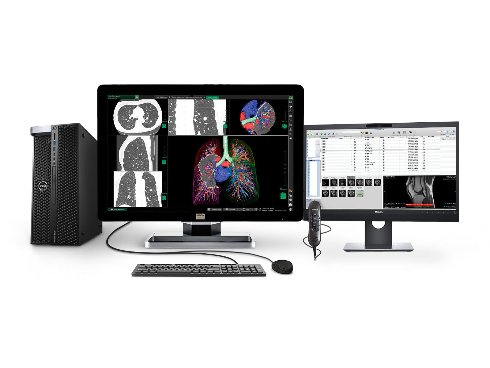 Barco Complete PACS General Radiology Station | Dell Workstation