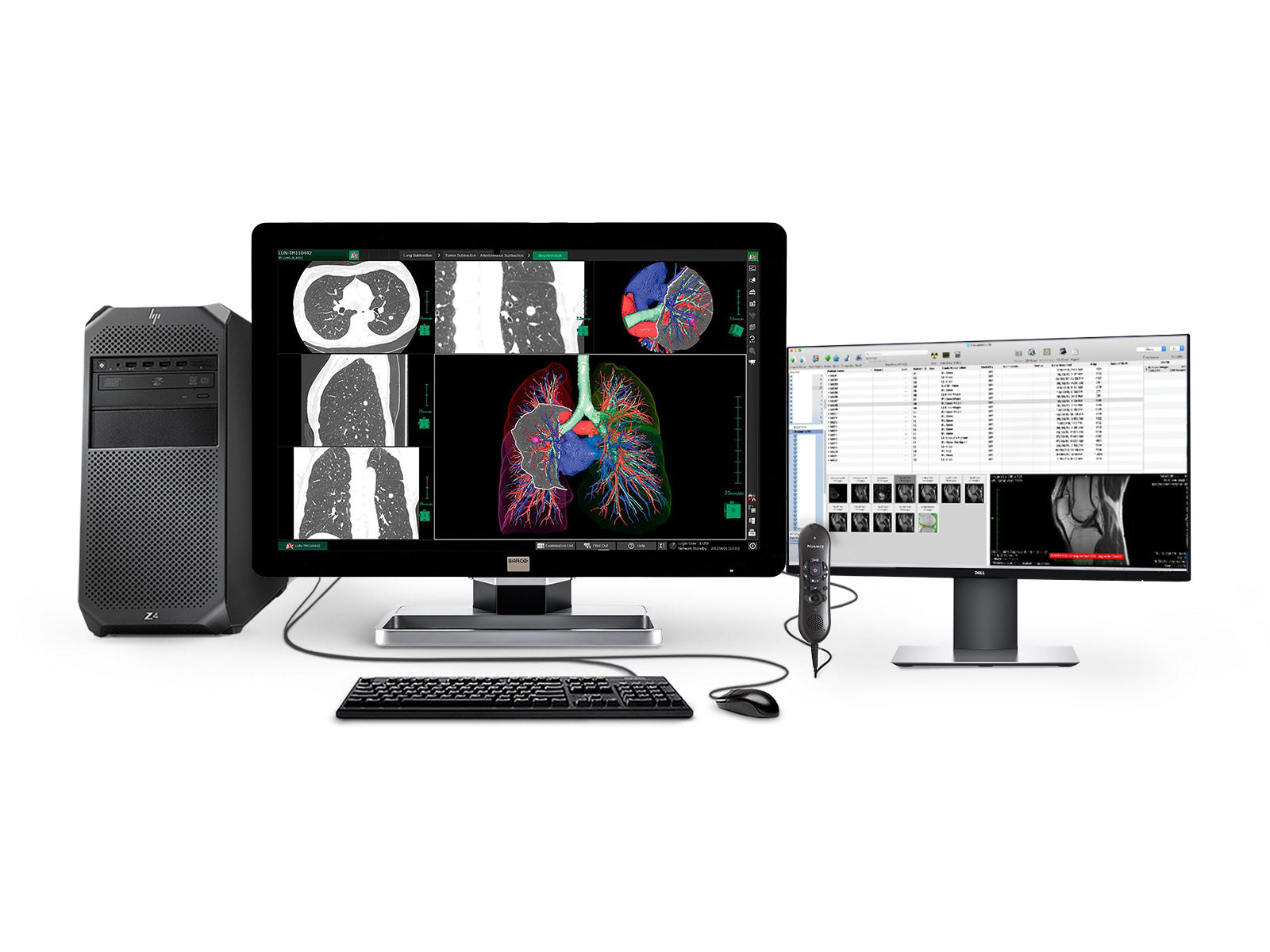 Complete PACS General Radiology Station | Barco 6MP Color LCD Display | HP Workstation | Dictation Mic | Worklist Monitor (6130Z4) Monitors.com 