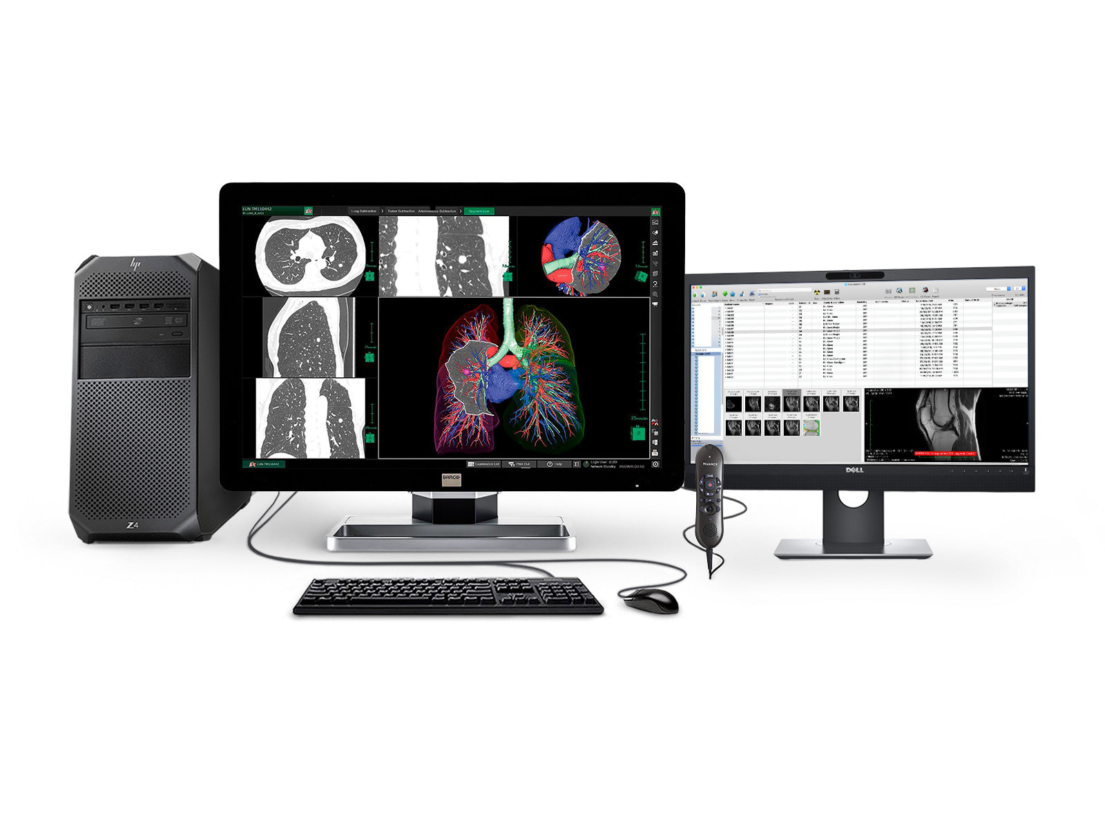 Barco Complete PACS General Radiology Station | HP Workstation