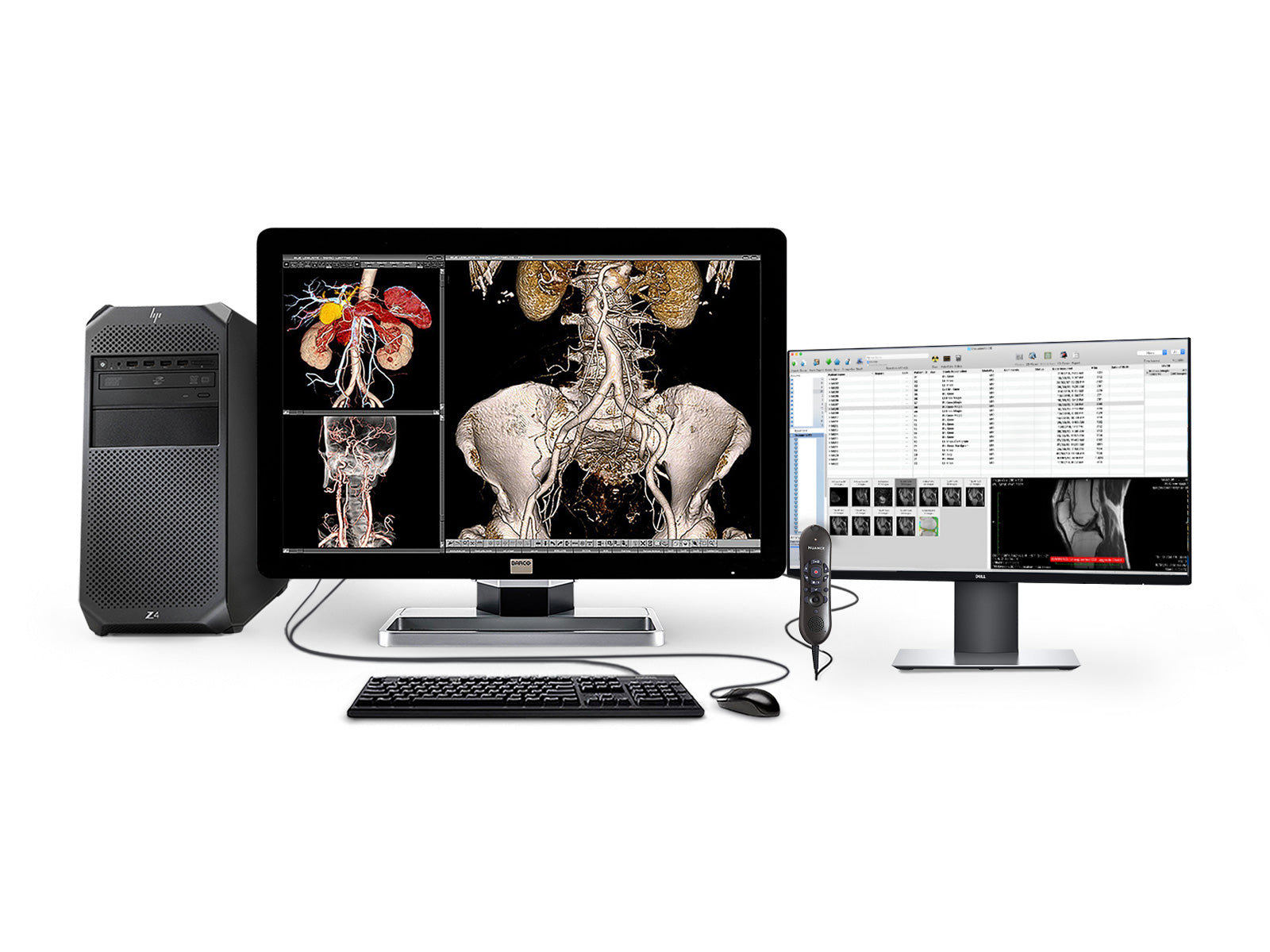 Complete PACS General Radiology Station | Barco 6MP Color LED Display | HP Workstation | Dictation Mic | Worklist Monitor (6230Z4R) Monitors.com 