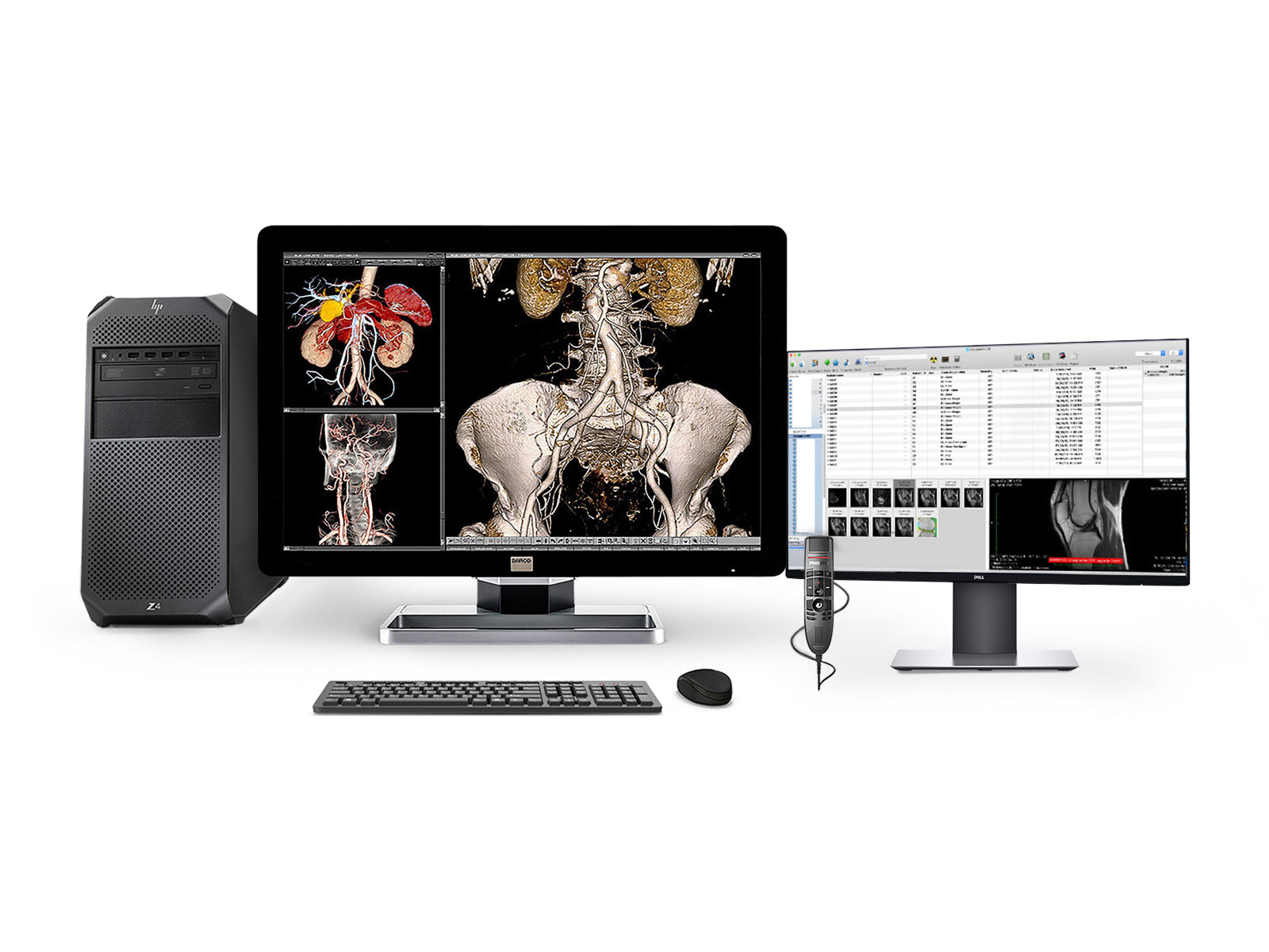 Complete PACS General Radiology Station | Barco 6MP MDCC-6230 Display | HP Workstation | Dictation Mic | Worklist Monitor (6230Z4R)