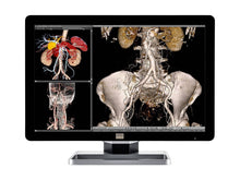 Barco Coronis Fusion MDCC-6230 6MP 30" Color LED General Radiology PACS Display