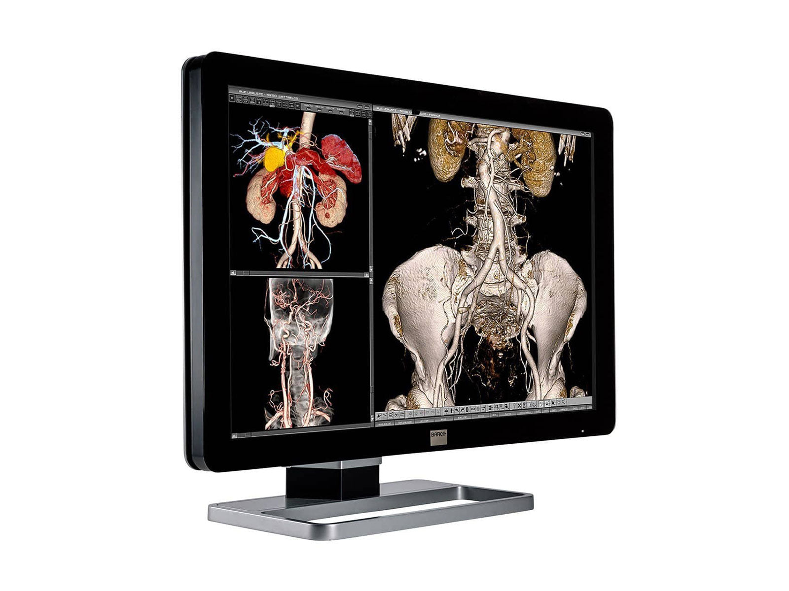 Barco Coronis Fusion MDCC-6230 6MP 30" Color LED General Radiology PACS Display (K9601450)