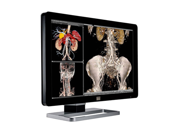 Barco Coronis Fusion MDCC-6230 6MP 30