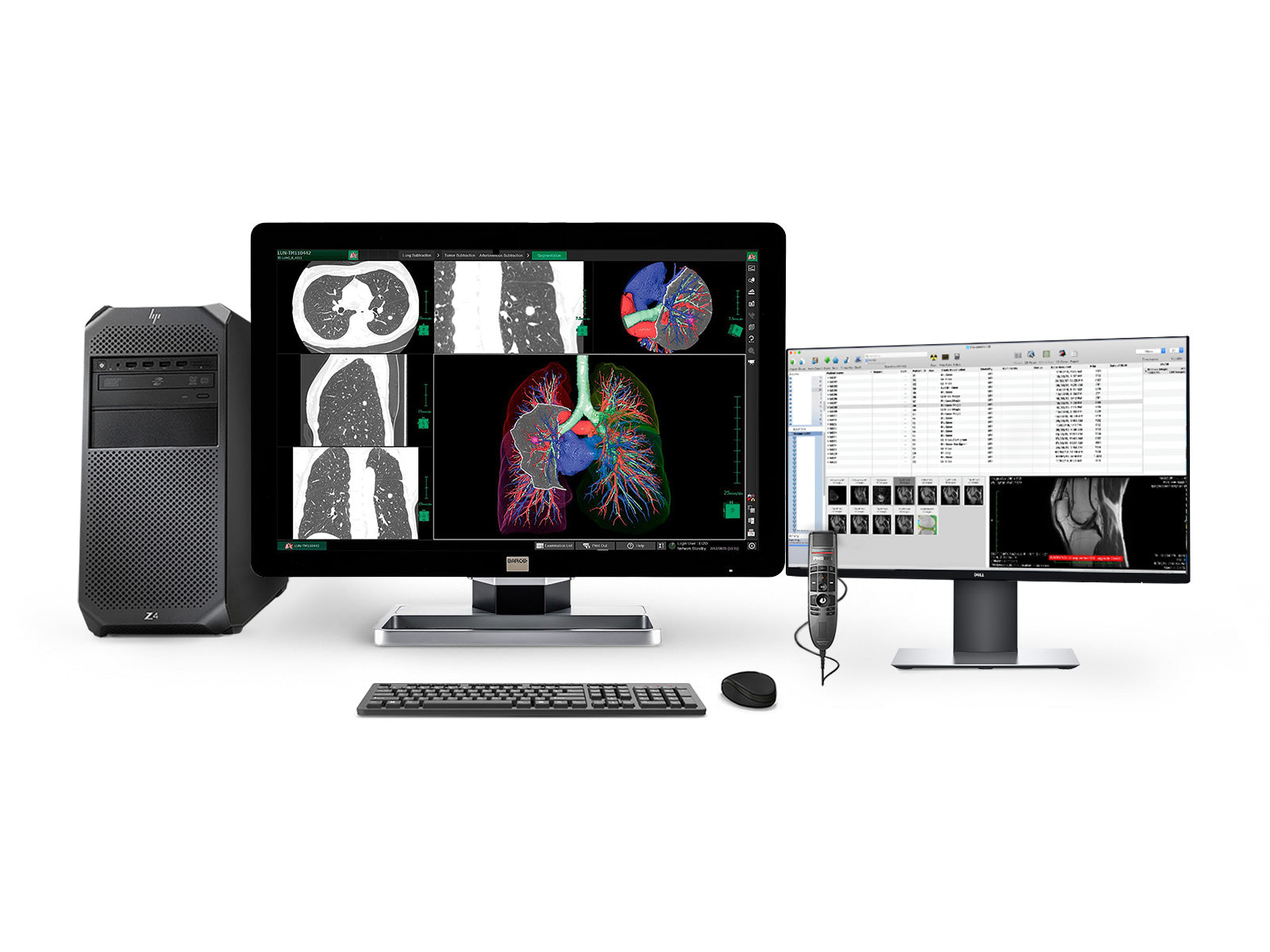 Complete PACS General Radiology Station | Barco Coronis MDCC-6330 6MP Color LED Display | HP Workstation | Dictation Mic | Worklist Monitor (6330Z4R)