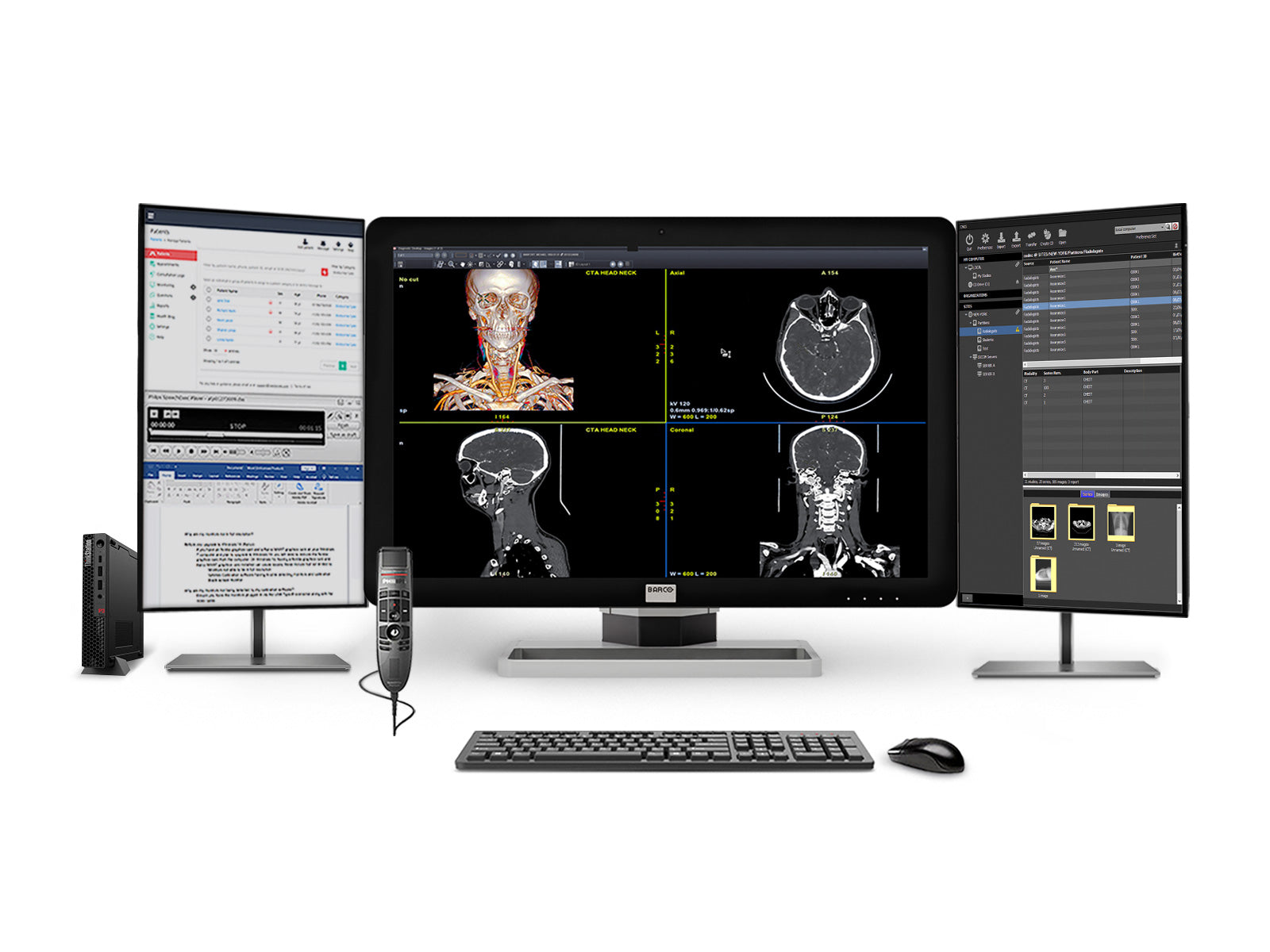 Barco Coronis Fusion MDCC-6430 6MP 30″ Radiology PACS Display + Lenovo ThinkStation P3 Tiny i9‑14900 64GB DDR5 Workstation + Philips SpeechMike Trackball Dictation Mic + Dual 24″ HD Worklist Monitors + Barco MXRT‑4700 GPU + Lenovo Keyboard & Mouse