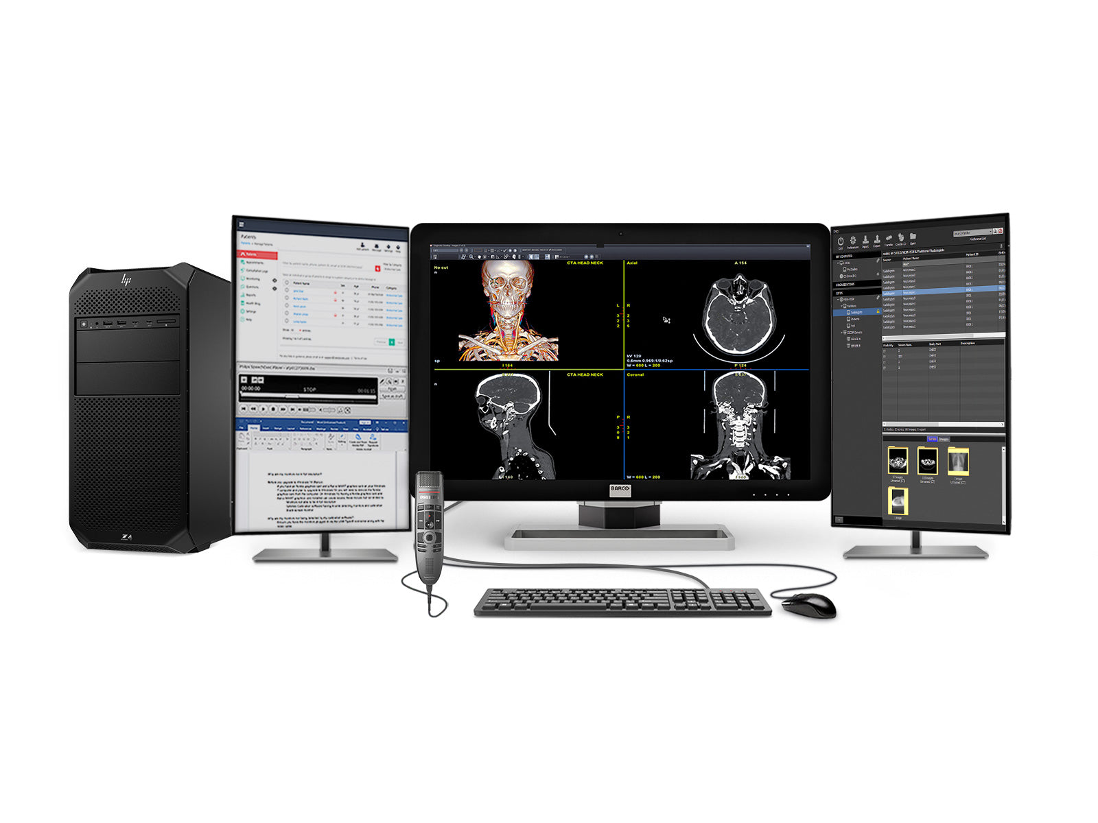 Compleet PACS Algemeen Radiologie Station | Barco 6MP LED-kleurenscherm | HP Z4 G5 werkstation | Dicteren Microfoon | Werklijst Monitor (6430Z4G5)