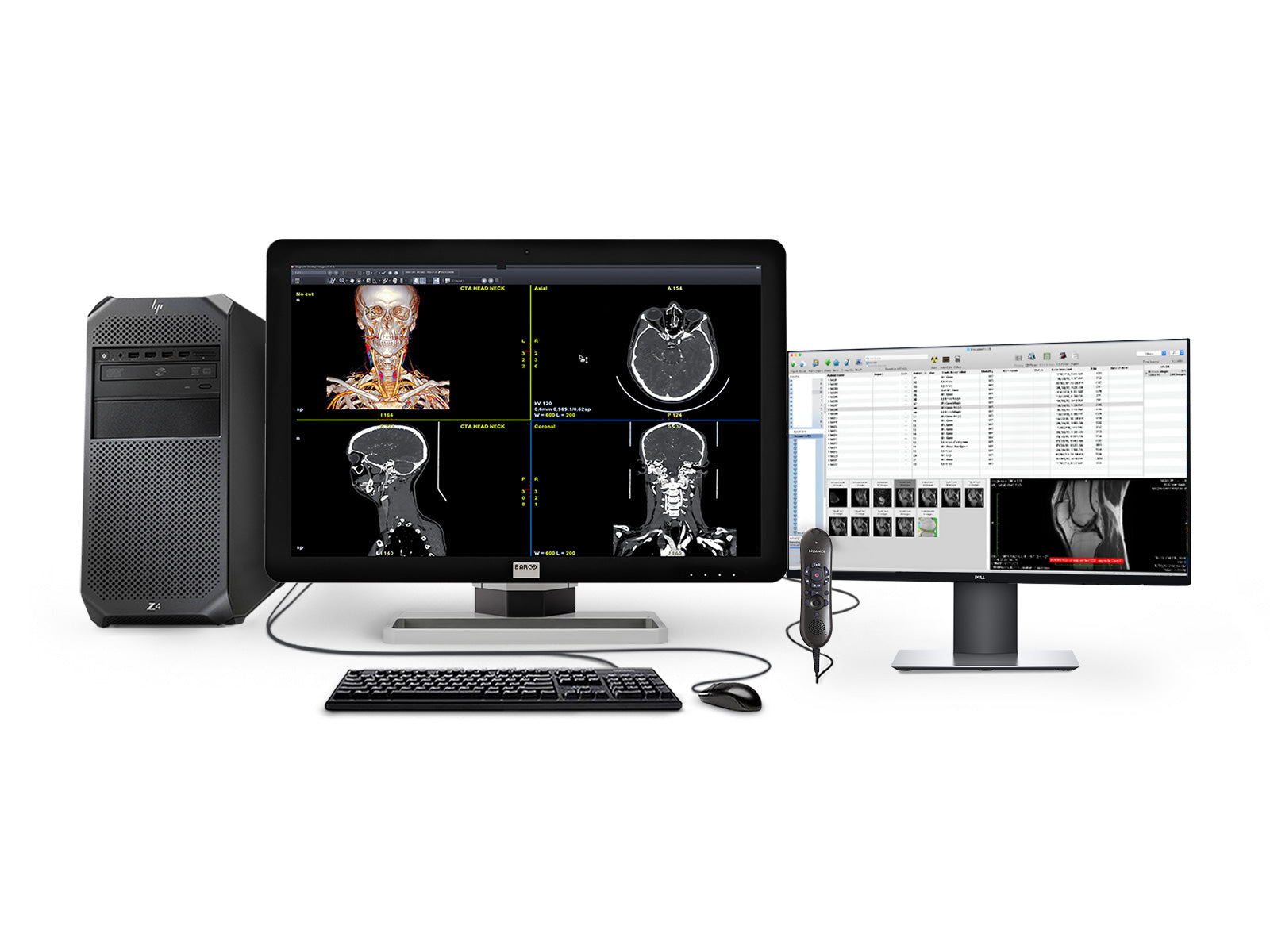 Barco General Radiology Reading Station | Coronis 6MP MDCC-6430 | HP Workstation | Nuance Mic | 24" Worklist Monitors (6430Z4R) Monitors.com 