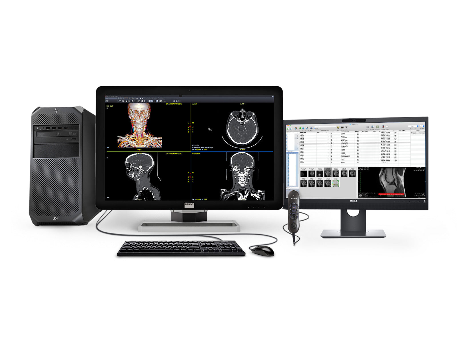 Barco Algemene radiologie -leesstasie | Coronis 6MP MDCC-6430 | HP Workstation | Nuance Mic | 24 "Werklysmonitors (6430Z4R)