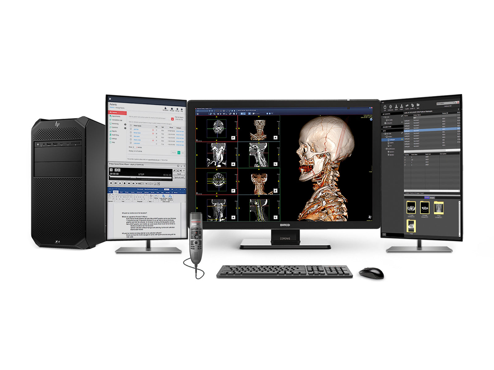 Complete PACS General Radiology Station | Barco Coronis MDCC-6530 6MP Color LED Display | HP Z4 G5 Workstation | Dictation Mic | Worklist Monitor (6530Z4G5)