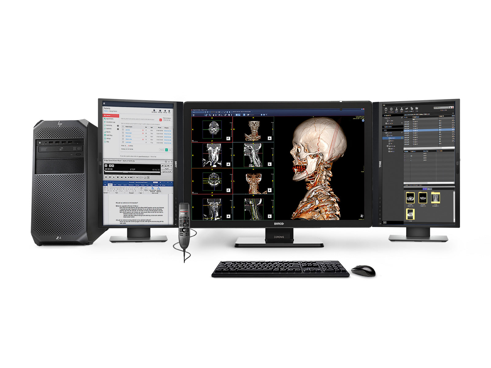 Complete PACS General Radiology Station | Barco Coronis MDCC-6530 6MP Color LED Display | HP Workstation | Dictation Mic | Worklist Monitor (6530Z4R)