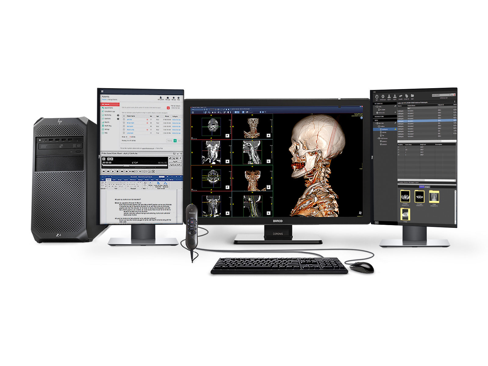 Complete PACS General Radiology Station | Barco 6MP Color LED Display | HP Workstation | Dictation Mic | Worklist Monitor (6530Z4R) Monitors.com 