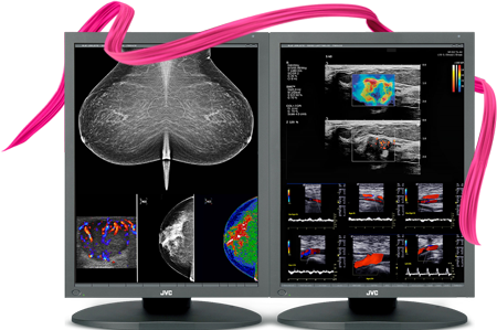5MP Color Mammography Monitors
