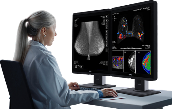 Great Deal on Color Mammo Tomo Monitors
