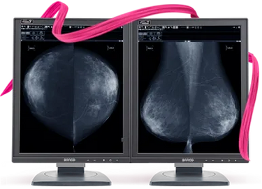 Barco 5MP Tomo Mammo Display
